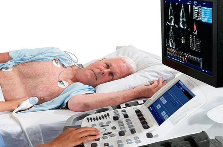 precio-de-ecocardigrama-en-cdmx